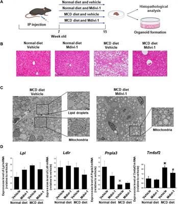 Evaluation of the efficacy of mitochondrial fission inhibitor (Mdivi-1) using non-alcoholic steatohepatitis (NASH) liver organoids